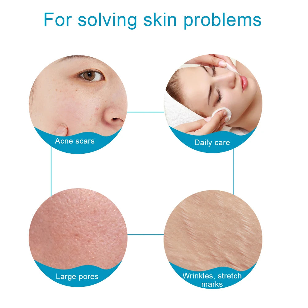 Facial Needle Derma Roller